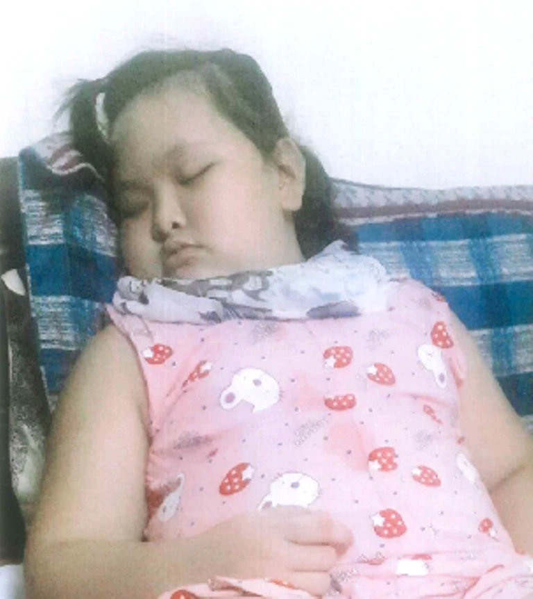 Cháu Hằng bị suy tim, tim to